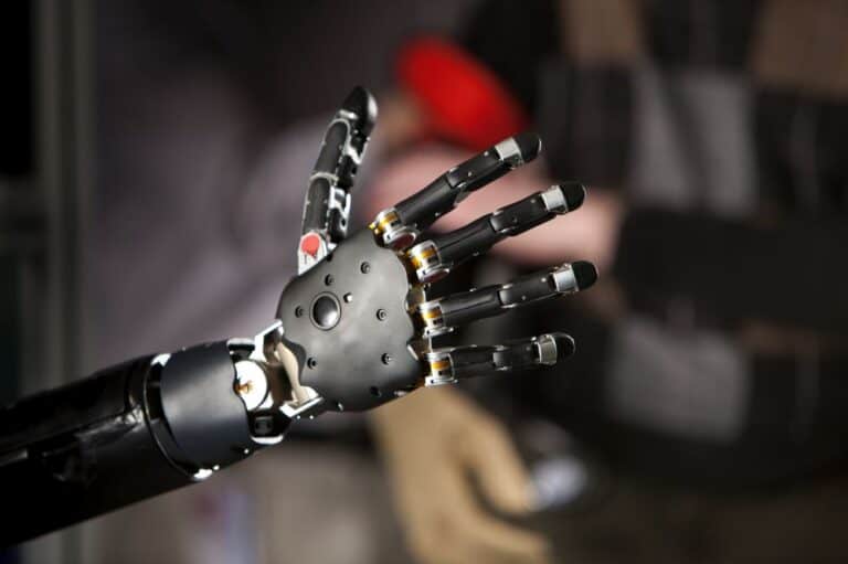 New Revolutionary Bionic Hand Gives Woman Ability to Touch and Feel